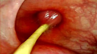 Anal POV Camera Inside Her Asshole as I Pound Her with Big Cock and Cum Deep