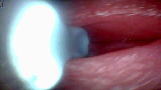 omg i filmed my cumshot deep inside with endoscope up close 😩