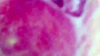 watch this real pussy contract in orgasm... cum mixes deep inside with her juicy squirt under microscope