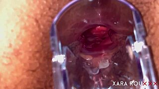 Huge Fat Ass BBW Spread Wide for Anal Speculum Gaping