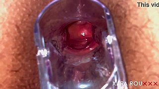 Huge Fat Ass BBW Spread Wide for Anal Speculum Gaping