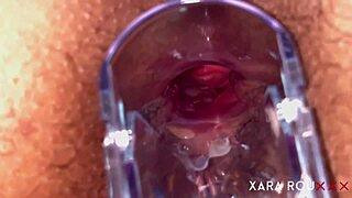 Huge Fat Ass BBW Spread Wide for Anal Speculum Gaping