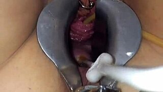 이 자궁경부 플레이가 바늘로 극단적, 야생 부인과 검사 세션 잘못됨